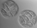 Ophiopholis Embryo